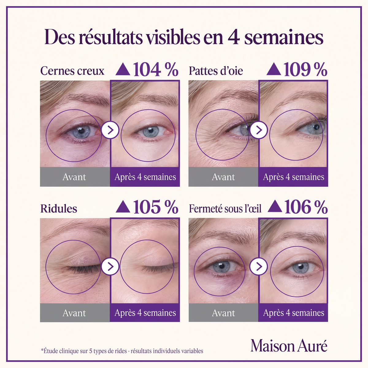 Des résultats visibles en 4 semaines — avant/après contour des yeux, Seringue Yeux Effet Filler Maison Auré