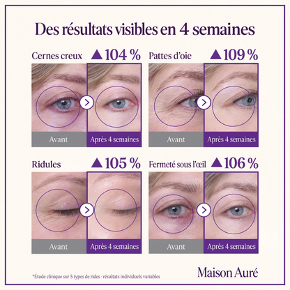 Des résultats visibles en 4 semaines — avant/après contour des yeux, Seringue Yeux Effet Filler Maison Auré