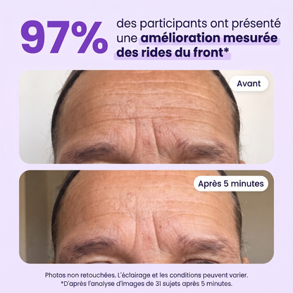 Avant / après 5 minutes — amélioration mesurée des rides