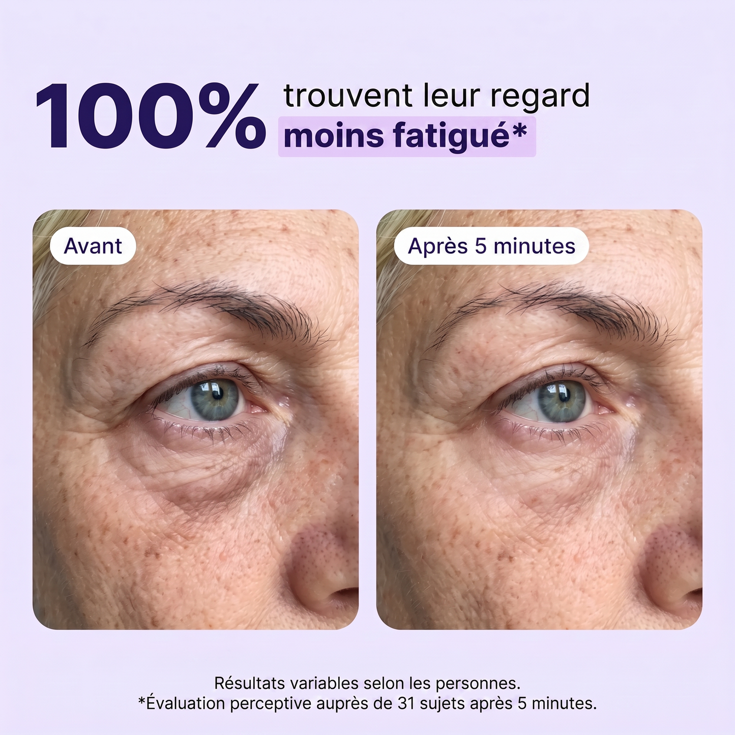 Avant / après 5 minutes — regard visiblement moins fatigué