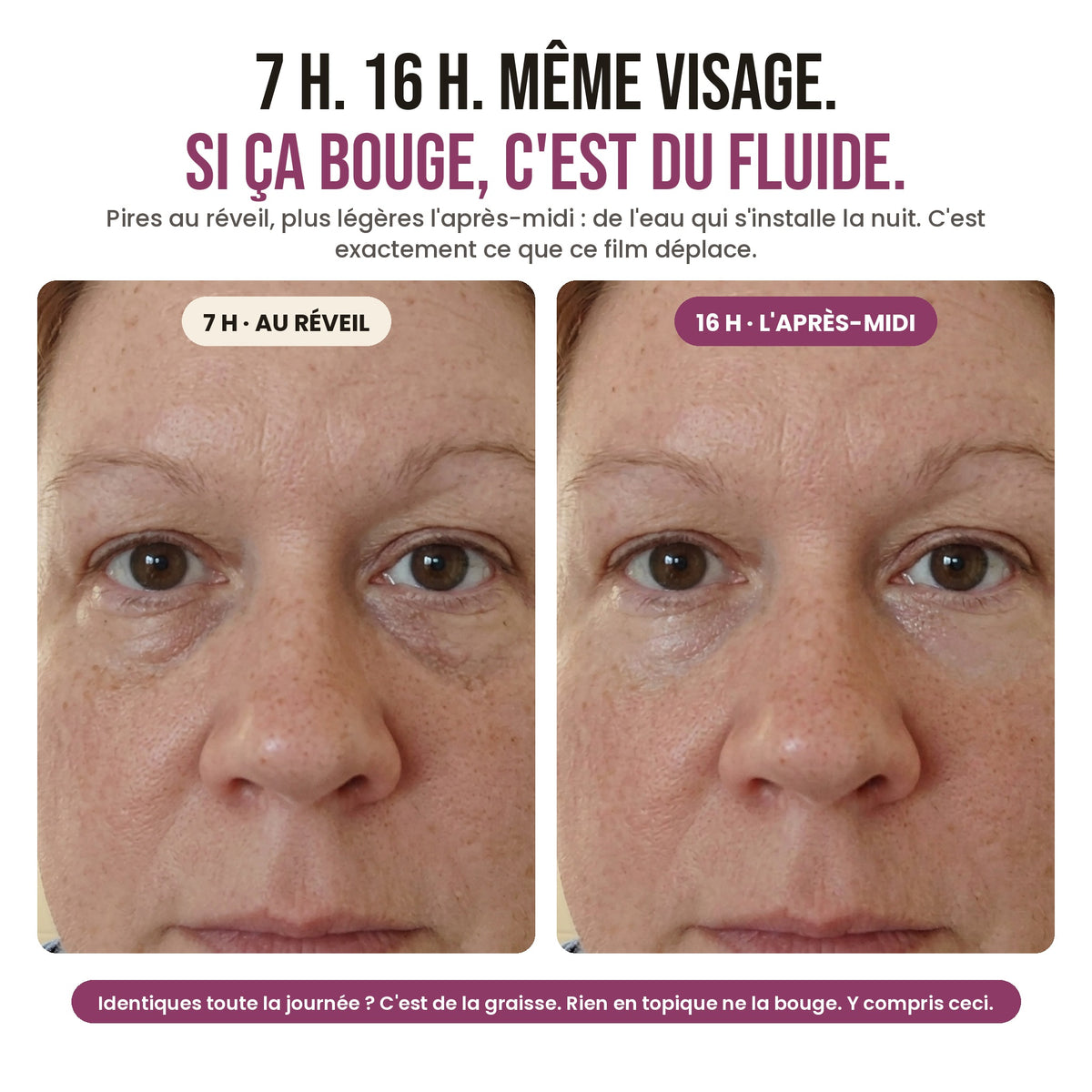 7 h et 16 h, même visage : si ça bouge, c'est du fluide