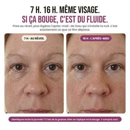 7 h et 16 h, même visage : si ça bouge, c'est du fluide