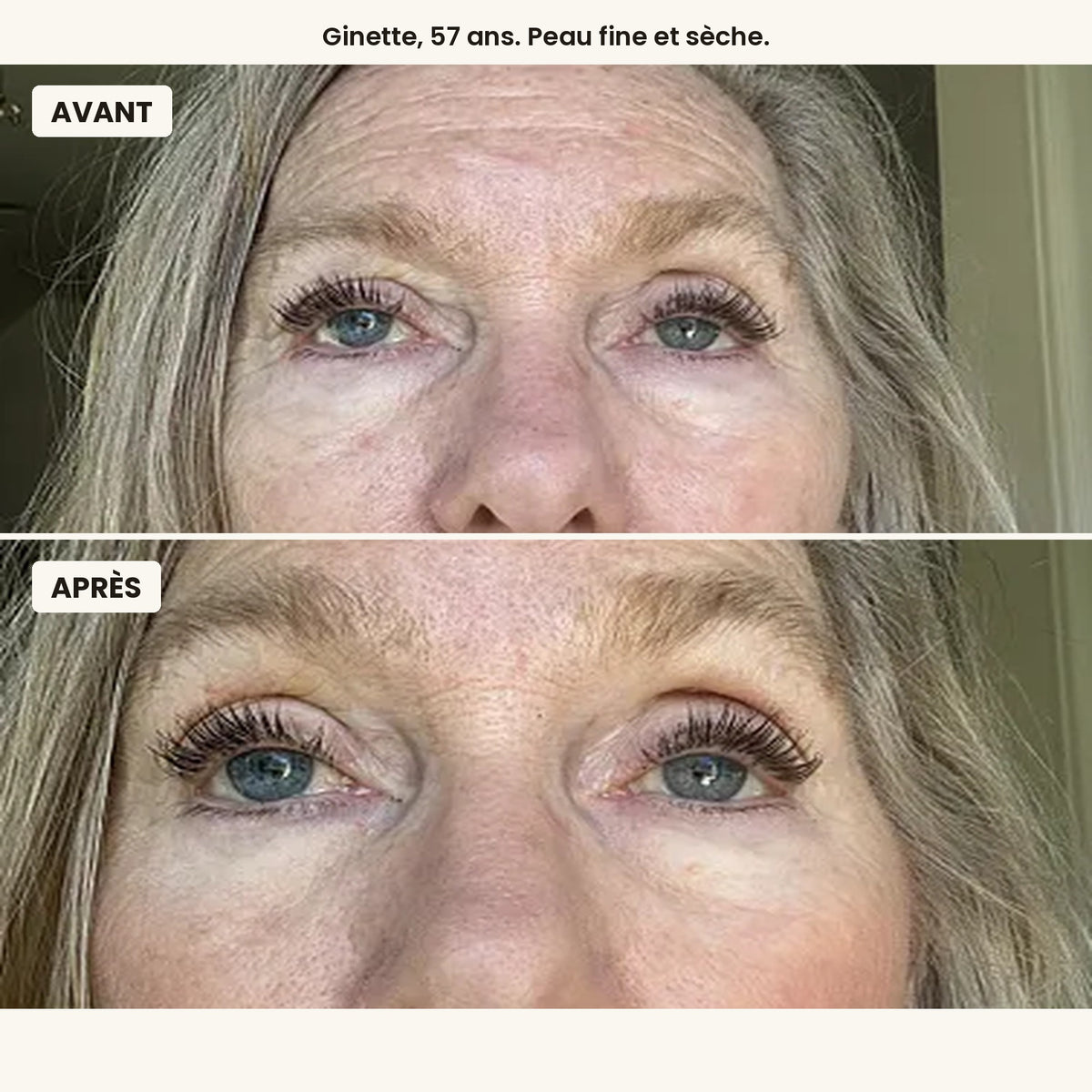 Avant / après, Ginette, 57 ans, peau fine et sèche