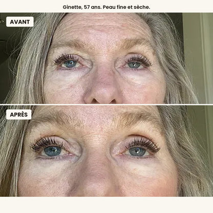 Avant / après, Ginette, 57 ans, peau fine et sèche