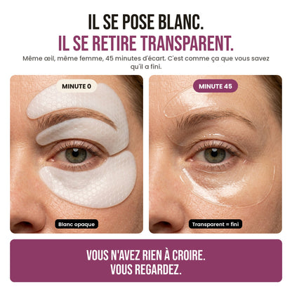 Il se pose blanc, il se retire transparent : même œil, minute 0 et minute 45